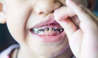 口腔護理可不是小事 聰明的媽媽從六個月開始就在科學保護